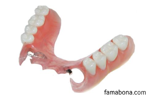 зъбни протези